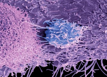 استفاده-از-آهن-در-سرطان-پروستات-مقاوم-به-درمان