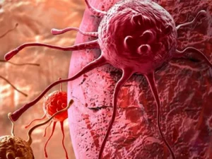 سرطان-پروستات-مقاوم-به-درمان