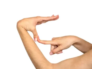 درمان سندروم مارفان