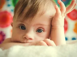نقش ژنتیک در بیماری سندروم داون