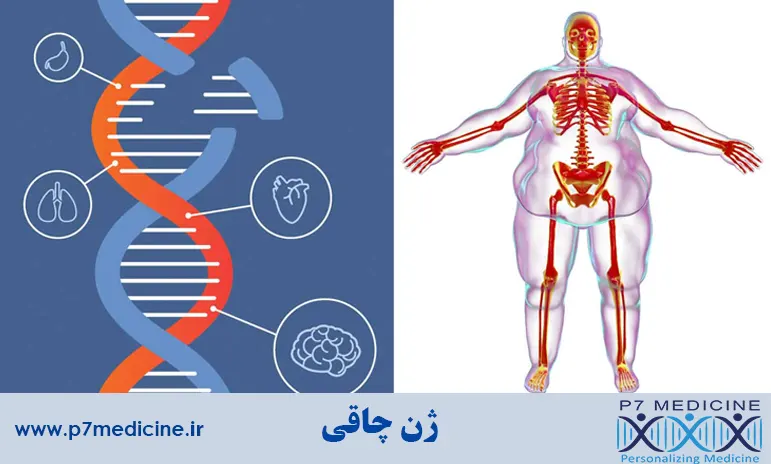 ژن چاقی