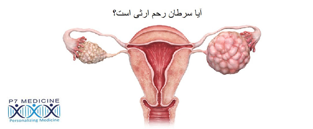 آیا سرطان رحم ارثی است؟