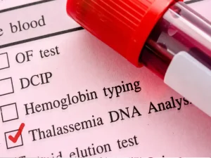 آزمایش ژنتیک ناقل تالاسمی