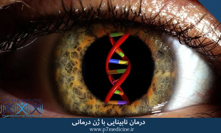 درمان نابینایی با ژن درمانی