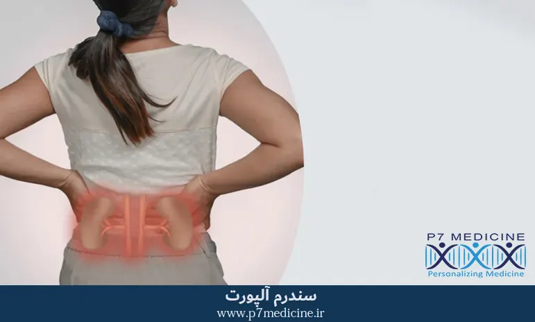 سندرم آلپورت سندرم آلپورت