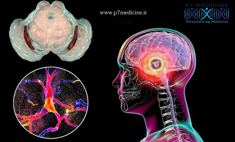 درمان پارکینسون با سلول‌های بنیادی