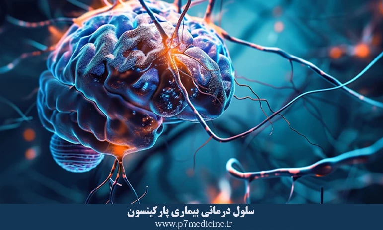 سلول درمانی بیماری پارکینسون