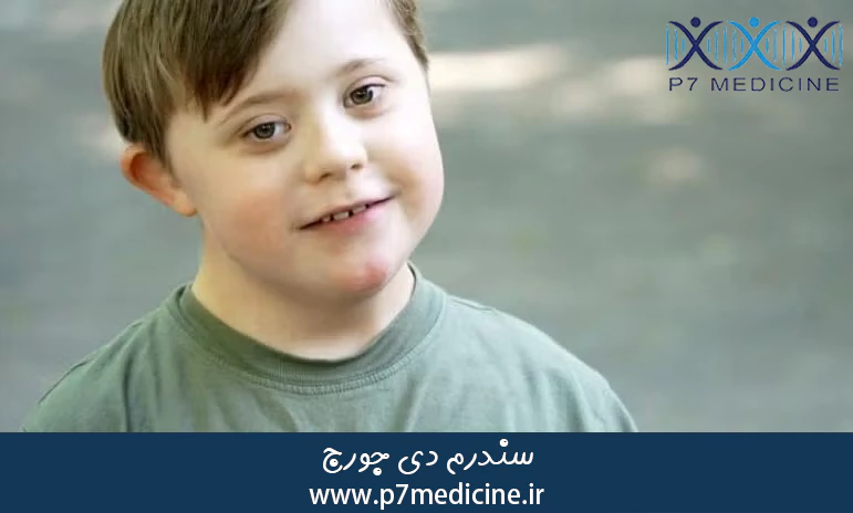 سندرم دی جورج