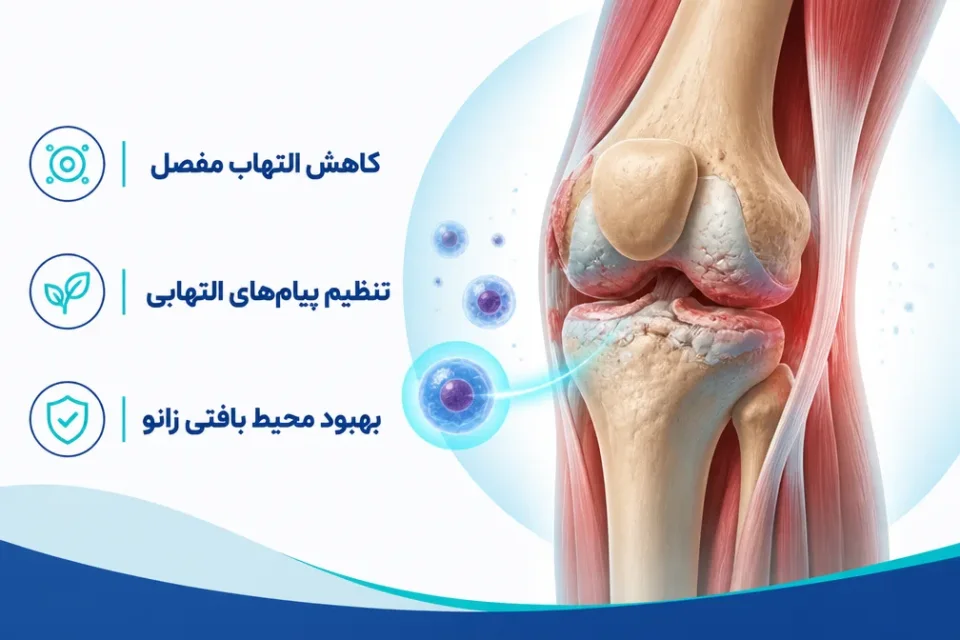 سلول بنیادی برای آرتروز زانو دقیقاً چه کاری قرار است انجام دهد — نمای شماتیک تغییرات مفصل زانو در آرتروز شامل کاهش غضروف و التهاب مفصل