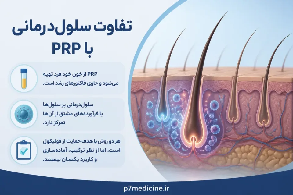 تفاوت سلولدرمانی با PRP